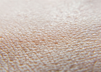 Dry air and our skin