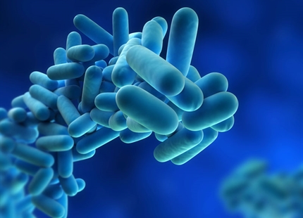 Legionnaires' disease - what you need to know.