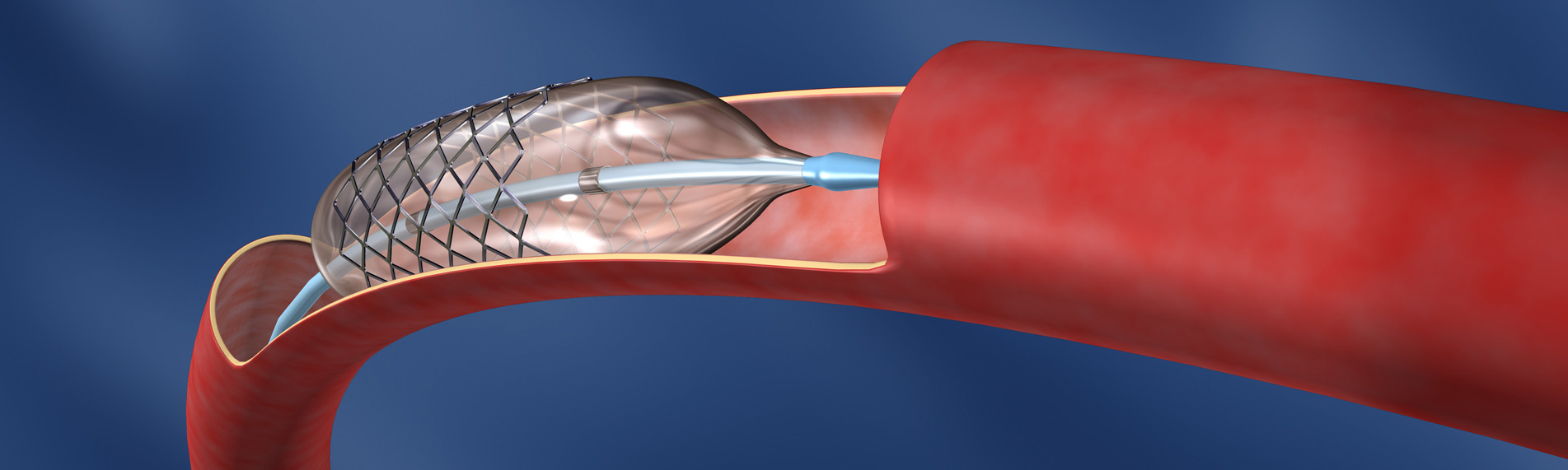 Humidification & humidity control in medical device manufacturing